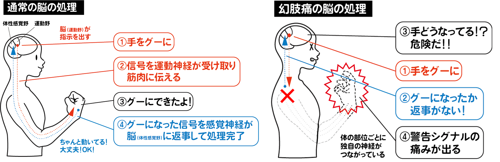 幻肢痛を感じるメカニズムと鏡療法の図解